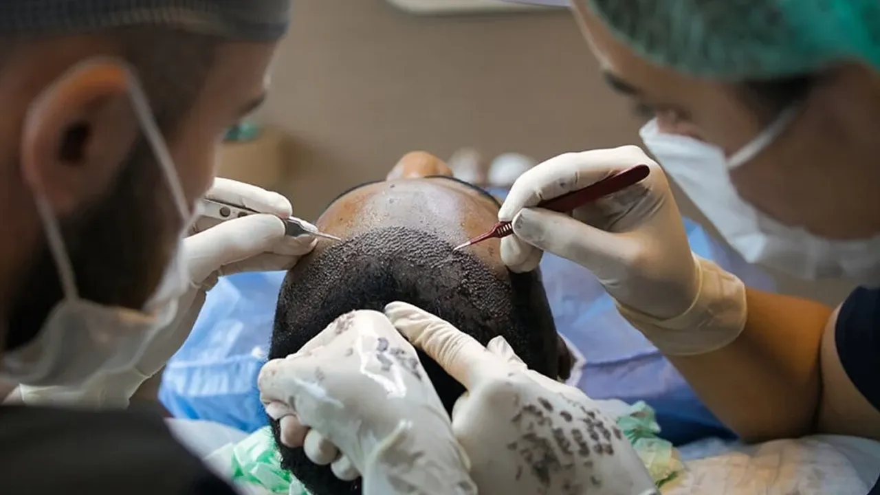 Sağlık Bakanlığı’ndan saç ekimi birimlerinde yeni dönem