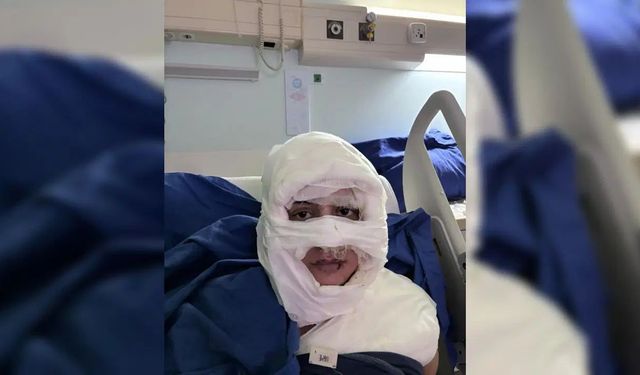 Kadıköy'de şoke eden şiddet: Kadını yaktı