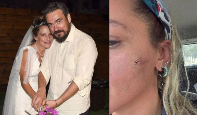 Yıldız Asyalı'nın eşi Demirci'den 'darp' iddiasına yanıt